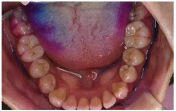 「妻が密かに怯えている“夫の口臭問題”。歯科医が教えるオーラルケア4か条」の画像