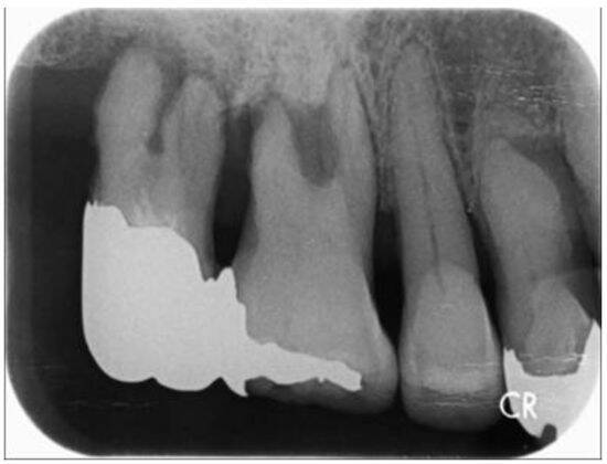 歯科医が警鐘「放置は危険」歯周病の知らないと怖い“全身への悪影響”