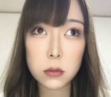 「「斜視あるある」がSNSで大反響。「目、どこ向いてんの？」蔑まれたコンプレックスを自ら発信する理由」の画像2