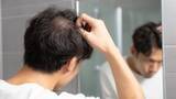 「鏡を見るのがツラい…薄毛で「美容室が苦痛」になった中年男性の苦悩。プロが“恥じる必要がない”と断言する理由」の画像2