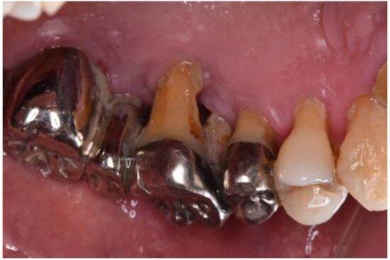 「忙しくて歯医者に行けなかった」歯の管理が下手な人ほど“損”をする。生涯医療費を左右する歯の健康