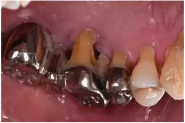 「「忙しくて歯医者に行けなかった」歯の管理が下手な人ほど“損”をする。生涯医療費を左右する歯の健康」の画像