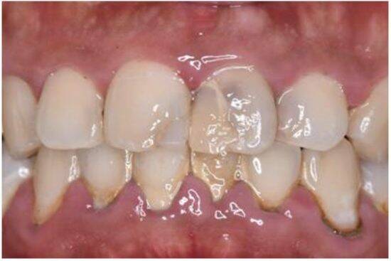 「忙しくて歯医者に行けなかった」歯の管理が下手な人ほど“損”をする。生涯医療費を左右する歯の健康