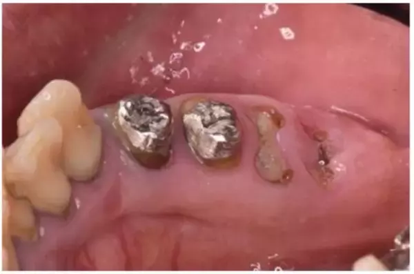 「「忙しくて歯医者に行けなかった」歯の管理が下手な人ほど“損”をする。生涯医療費を左右する歯の健康」の画像