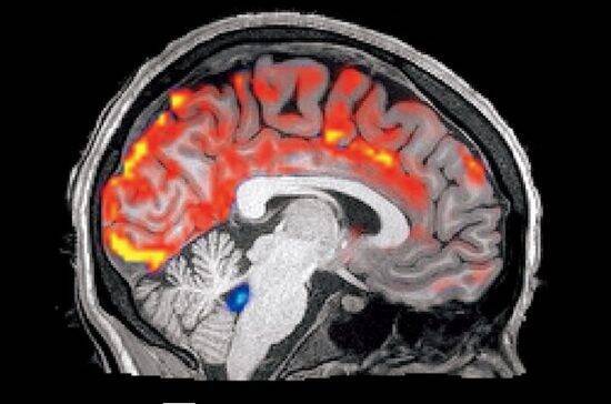 「週末の寝だめ」が認知症のリスクを増大させる…睡眠専門医が教える“睡眠負債”の恐怖