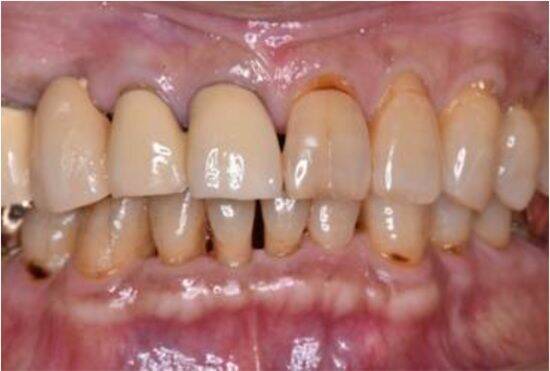 歯医者がむし歯より警戒する“沈黙の病”の怖さ。「まだ大丈夫」を放置すると「高級車1台分のお金を失う」