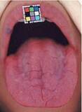 「口臭と舌の状態でわかる「病気のリスク」。15年間で5000人の口臭を嗅いできた歯科医に聞いた」の画像2