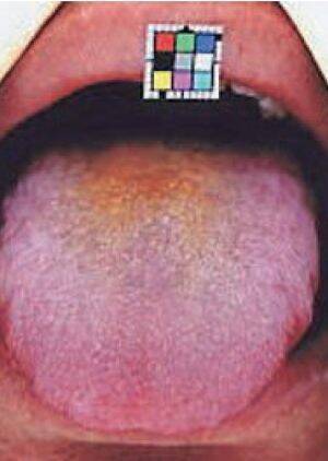 口臭と舌の状態でわかる「病気のリスク」。15年間で5000人の口臭を嗅いできた歯科医に聞いた
