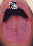 「口臭と舌の状態でわかる「病気のリスク」。15年間で5000人の口臭を嗅いできた歯科医に聞いた」の画像4
