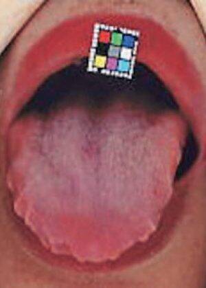 口臭と舌の状態でわかる「病気のリスク」。15年間で5000人の口臭を嗅いできた歯科医に聞いた