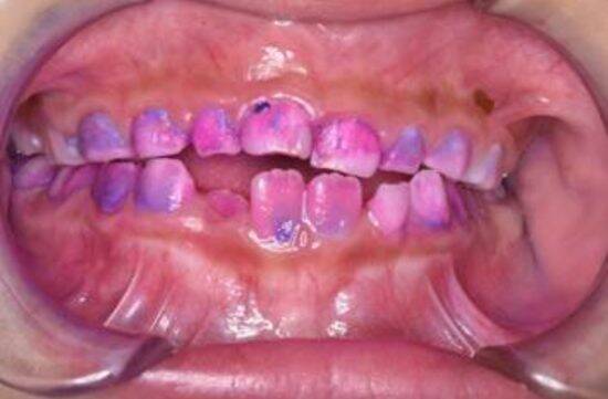 「歯の健康は一生の財産」歯科医師がライフステージ別の予防歯科ポイントを解説