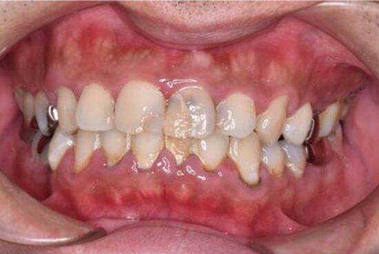 「歯の健康は一生の財産」歯科医師がライフステージ別の予防歯科ポイントを解説