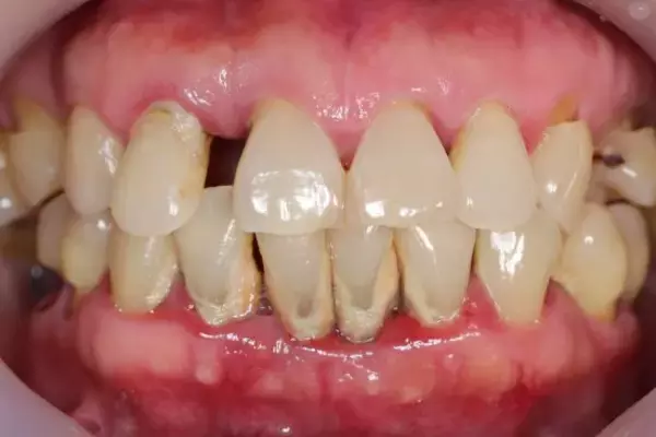 「「歯の健康は一生の財産」歯科医師がライフステージ別の予防歯科ポイントを解説」の画像