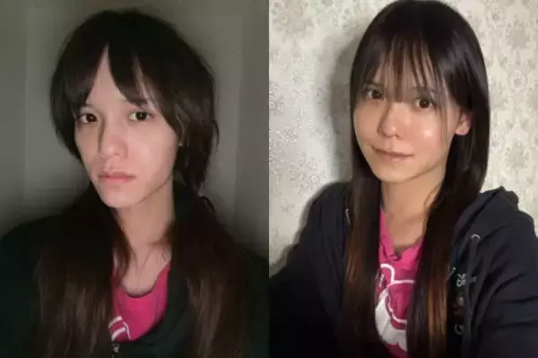 「120万円かけて「豊胸手術」した33歳男性を直撃「ゲイでもない。性同一性障害でもない」」の画像