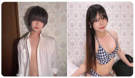 120万円かけて「豊胸手術」した33歳男性を直撃「ゲイでもない。性同一性障害でもない」