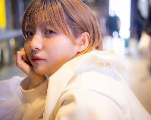 「身体が赤い斑点だらけ、顔もパンパンに」“汗をかくと症状が出る病気”に苦しんだアイドル。顔が腫れてもステージに立ち続けた10年