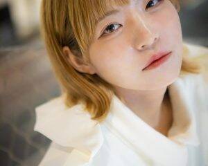 「身体が赤い斑点だらけ、顔もパンパンに」“汗をかくと症状が出る病気”に苦しんだアイドル。顔が腫れてもステージに立ち続けた10年