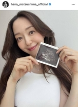 松島花３６歳、第１子妊娠を報告「小さな命に、感謝の気持ちでいっぱい」「出産は冬頃」流産経験も明かす…７年前に「令和婚」