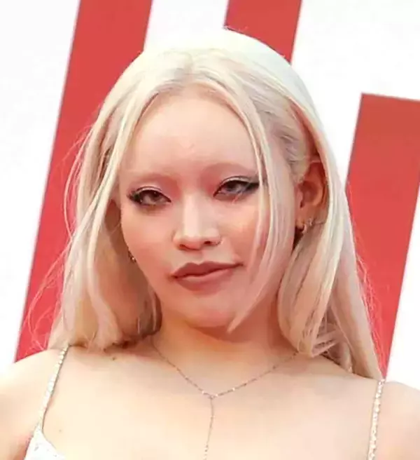 ちゃんみなの顔面にフォロワー衝撃「コワッ！」「なんで」「パワーアップし過ぎ」「レスラー？」