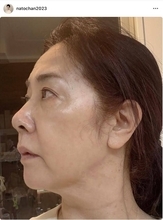 「高齢者ってことかしら、、、」名取裕子、手術を受けたことを報告「辛いですね」「大丈夫ですか？」「スッピン…綺麗すぎます」