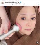 「４３歳・矢口真里、すっぴんショットにファン驚き！美容医療施術の「ドアップ」公開「可愛いしかない」」の画像1