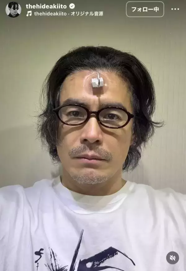 ５０歳・伊藤英明の大発明！？おでこにフック付けてメガネを動かすと…驚きの声「おデコが大変な事に」「澄んだ瞳」