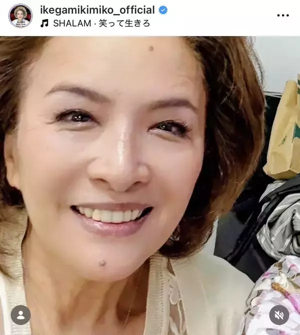 「歯抜け」で話題の６７歳女優「治療中で仮歯だった」「アロンアルファ…」「写真が世界に晒されて」衝撃の裏側明かす…池上季実子