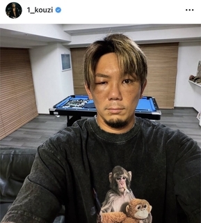 人気格闘家の顔面に異変「何があった」「どしたん」「お大事に」…「顔ごっつい腫れて」皇治が報告「顔、半分誰がわからんねんけど」