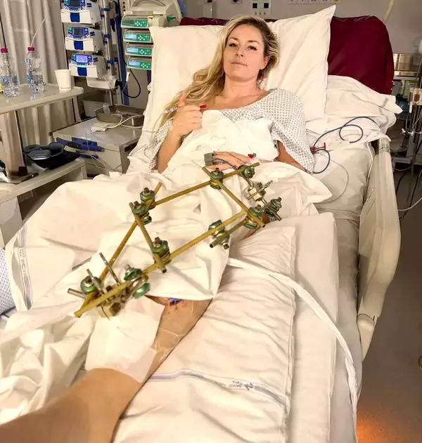 「スキーの女帝」リンゼイ・ボンが「３回目の手術成功」「私は大丈夫」明かす…ＳＮＳにベッドに横たわる姿