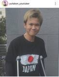 「手術を公表のゆたぼん「１７歳になりました！」退院報告…「自宅で療養していきます」バイクで人身事故」の画像1