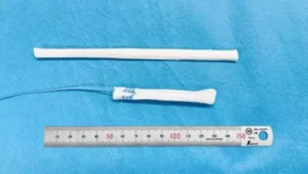 【日本ハム】ウシ由来靭帯デバイス開発のCTBE社に出資、膝前十字靭帯断裂などのスポーツ医療の課題解決を支援