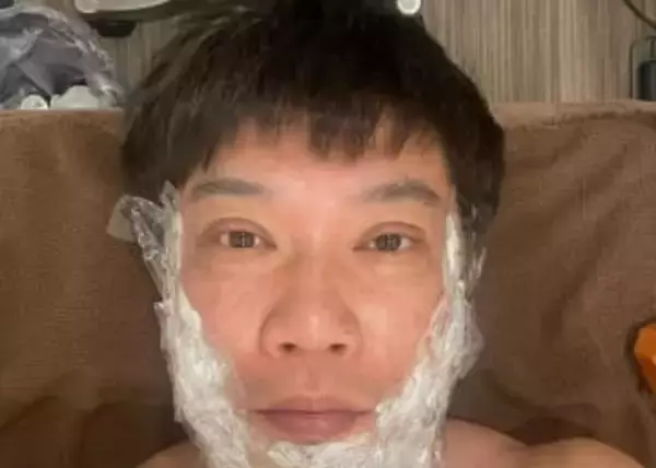 【 TKO・木本武宏 】　人生初「顔のイボ取り」を報告　「細かく100個くらいあるんやって　まず今日はまず30個ほど取る」