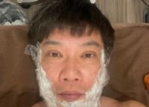 【 TKO・木本武宏 】　人生初「顔のイボ取り」を報告　「細かく100個くらいあるんやって　まず今日はまず30個ほど取る」