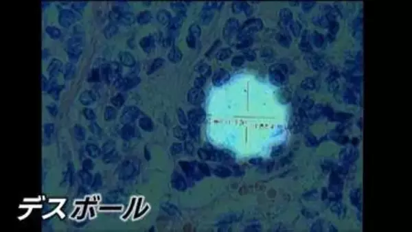 「デスボール」原爆の放射線が体内に留まり細胞に“穴”を　最新の研究発表が波紋…長崎原爆から81年　置き去りの被爆体験者【NO WARプロジェクト つなぐ、つながる】