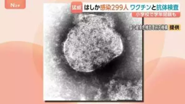 去年すでに上回る「はしか」感染299人　都内小学校では「学年閉鎖」も　厚労省はワクチン2回接種を呼びかけ