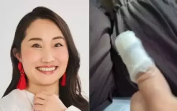 【 キンタロー。 】　火傷で病院に「2度だった」　「R1準決勝だめで落ち込んでいたら」「素手で熱々の鍋の蓋を持つと言う失態を」　「めちゃくちゃ火傷痛いので」うずくまる