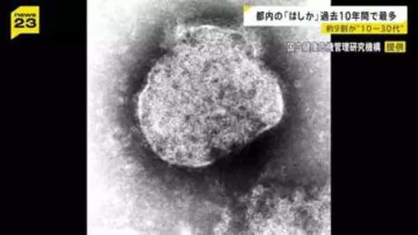 10年間で過去最多の132人 　都内の「はしか」感染者　10代～30代が9割近く