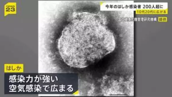「はしか」感染広がる　10代…32%、20代…25%　今年の感染者236人（今月5日時点）
