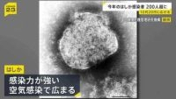 「はしか」感染広がる　10代…32%、20代…25%　今年の感染者236人（今月5日時点）