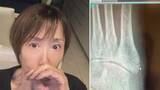 「【 奈美悦子(75) 】絨毯に引っかかりテレビに激突　「右足にヒビが　情けない話です」「しばらく大人しくしています」」の画像1