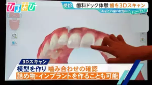 2人に1人が『歯周病』…予防に有効な「歯科ドック」って何をする？歯科医が教える簡単ケア術【ひるおび】