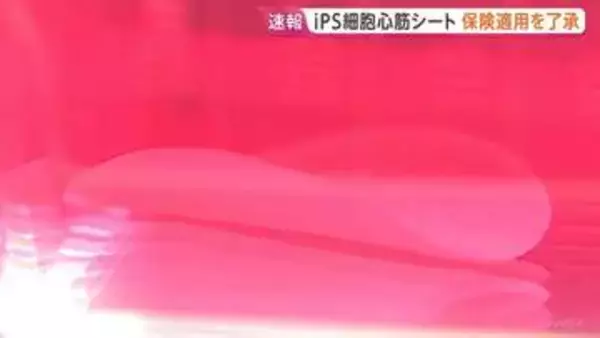 iPS細胞心筋シート「リハート」医療保険の適用を了承　心不全の治療用