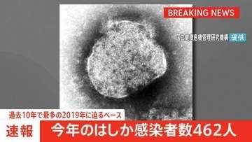【速報】今年のはしか感染者数462人　過去10年で最多だった2019年に迫るペース　厚生労働省