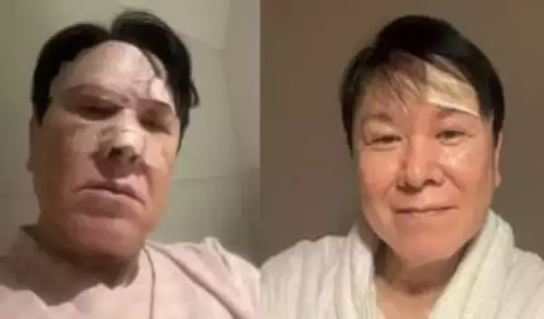 【 三ツ矢雄二 】転倒・鼻を骨折から1か月　CT検査の結果〝頭の中の出血は消えて〟〝ジンジンが無くなるまで安静に〟　「心はとても元気で健やか」笑顔で投稿