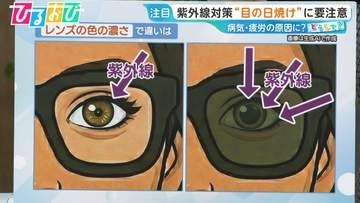 サングラスの色は薄めが良い！？「目の日焼け」白内障や疲労の原因にも…眼科医の教える対策は【ひるおび】