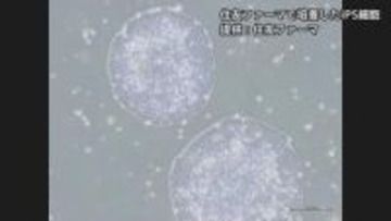【速報】iPS細胞使ったパーキンソン病患者の再生医療製品「アムシェプリ」 公的医療保険の適用を了承 価格は約5530万円 中医協