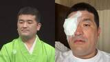 「【 すゑひろがりず・三島達矢 】　右目白内障で手術　「手術時間も短く無事に成功」　 SNSに本人明かす　「原因はアトピーの合併症らしく」」の画像1