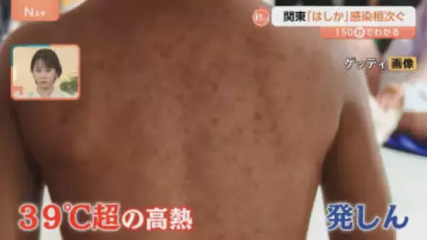 極めて感染力が強い「はしか」関東で報告相次ぐ　感染すると免疫がリセットされることも【Nスタ解説】