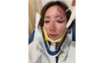 【 釣りアイドル・神野梓 】　車大破の事故　命を救った「iPhoneの『衝突事故検出』機能」　強い衝撃を感知後　「反応がないと119や緊急連絡先に自動通報してくれます」