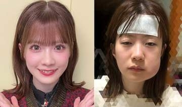 【 NMB48・松岡さくら 】 「アイドルのオンとオフ 」　投稿写真にＷＥＢ騒然　「オンとオフの差すごっ！笑笑」「めっちゃ腫れすぎてる！」「同一人物なの？笑」